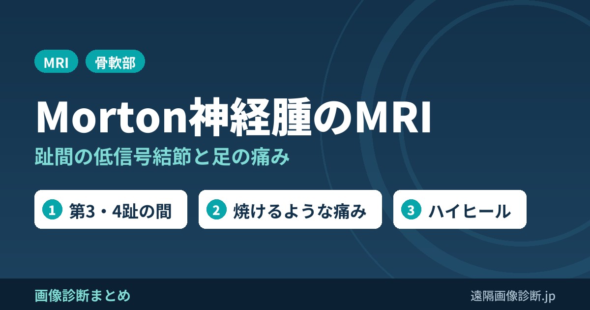 Morton神経腫(モートン病)のMRI画像所見｜趾間の低信号結節