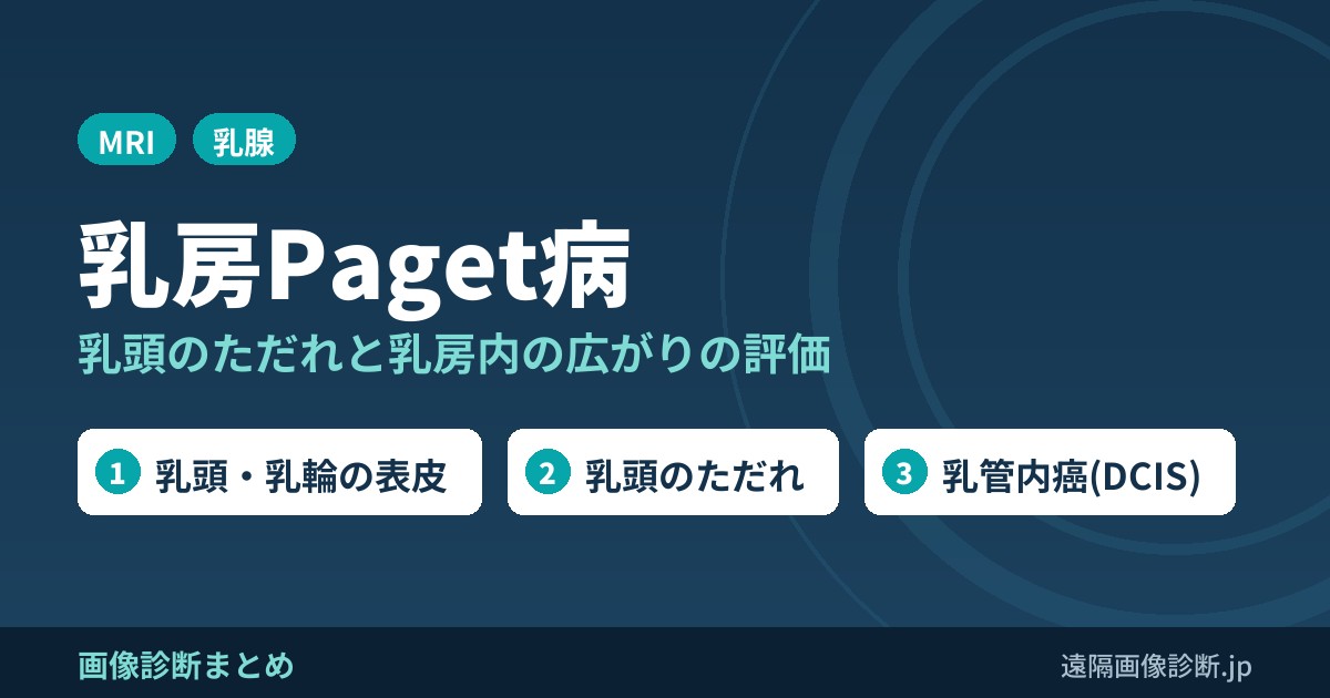 Paget病の画像診断(Paget’s disease)