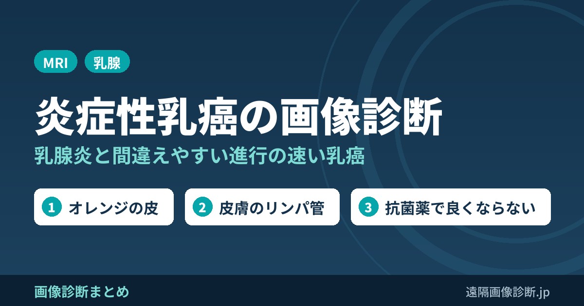 炎症性乳癌の画像診断