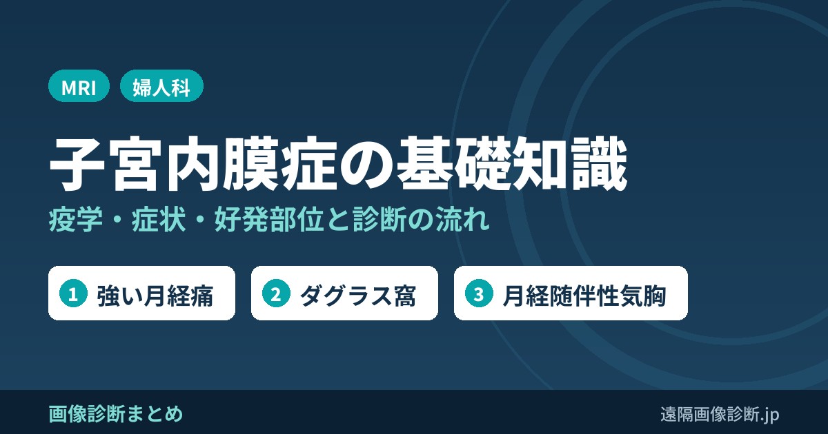 子宮内膜症まとめ(疫学、症状、診断)