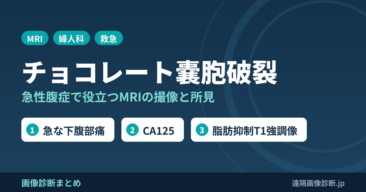 内膜症性嚢胞(チョコレート嚢胞)破裂とは？MRI画像診断のポイントは？