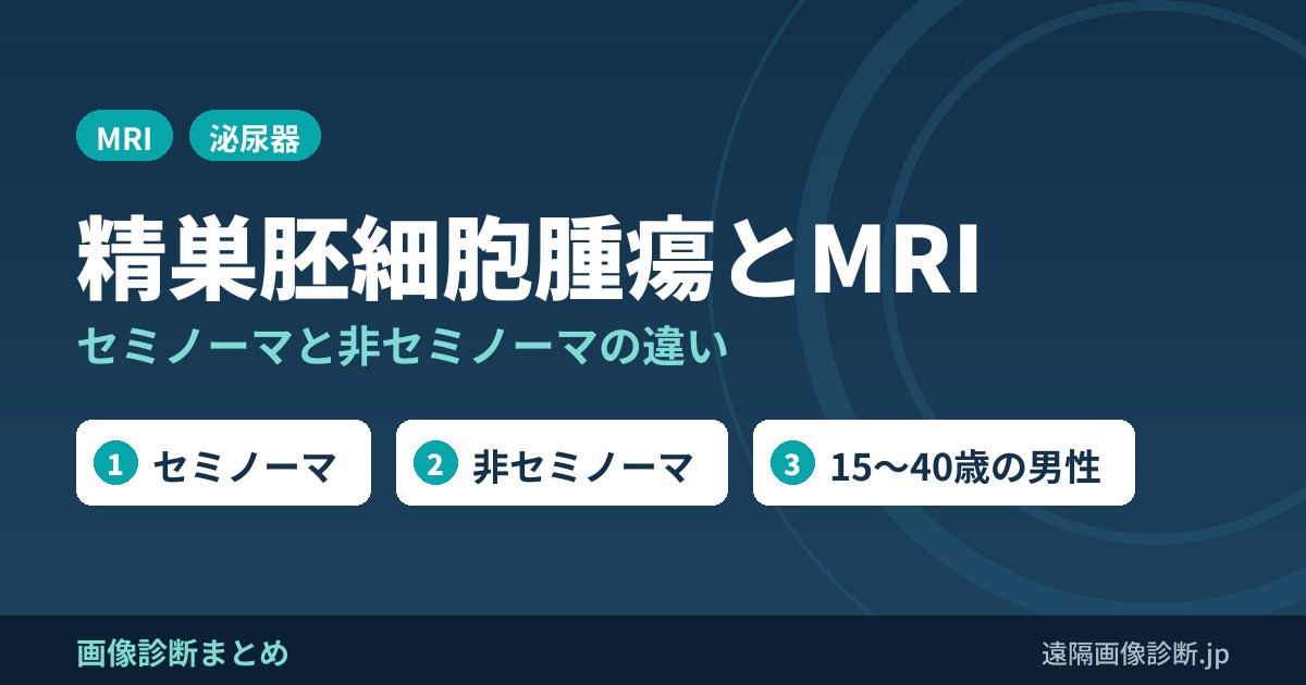 精巣胚細胞腫瘍とは？セミノーマとは？MRI画像診断のポイント！