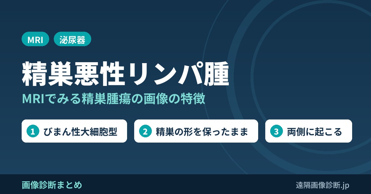 精巣悪性リンパ腫の画像診断