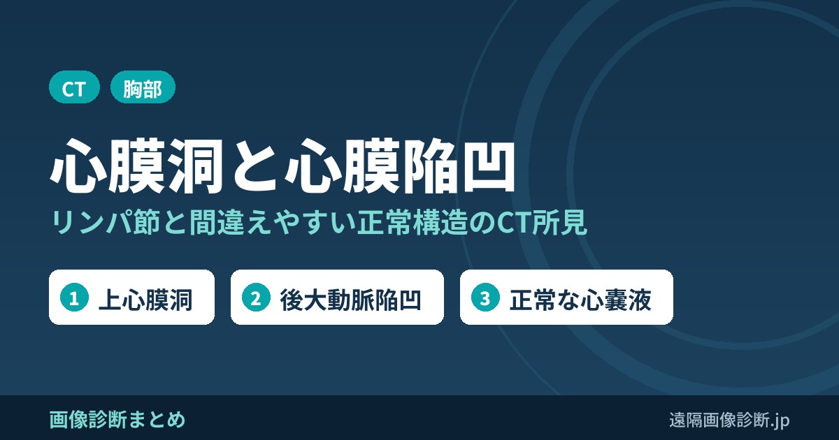 心膜洞(心膜陥凹)とは？胸部CTでリンパ節と間違えやすい上心膜洞・後大動脈陥凹