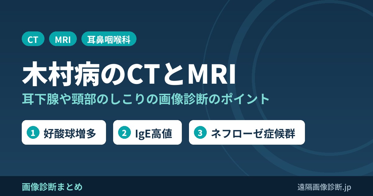 木村病(木村氏病)とは？CT,MRI画像診断のポイント