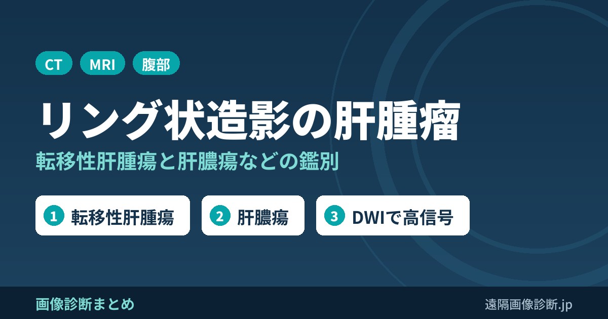 リング状増強効果を示す肝腫瘤の鑑別診断