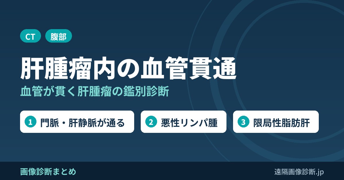 肝腫瘤内血管貫通の鑑別診断