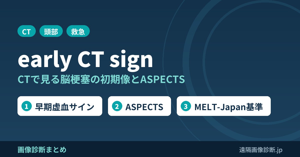 early CT sign(早期虚血サイン)とは？CTで見る脳梗塞の初期像とASPECTS・MELT-Japan基準