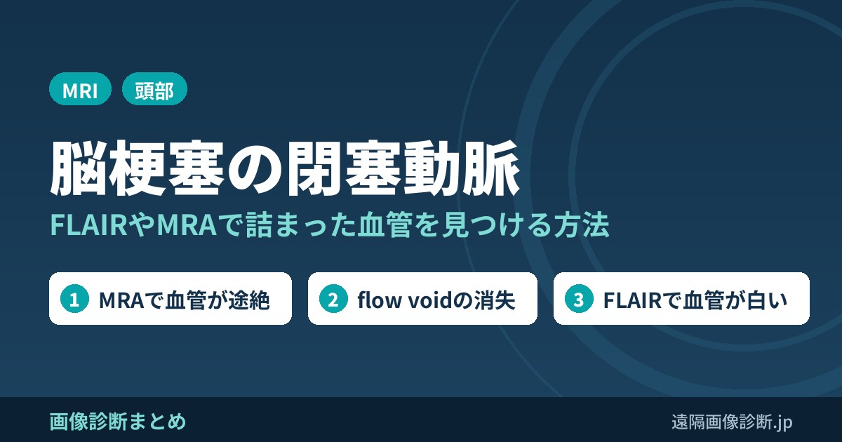 脳梗塞の閉塞動脈の画像診断｜FLAIRのintraarterial signal・hyperdense sign・MRA