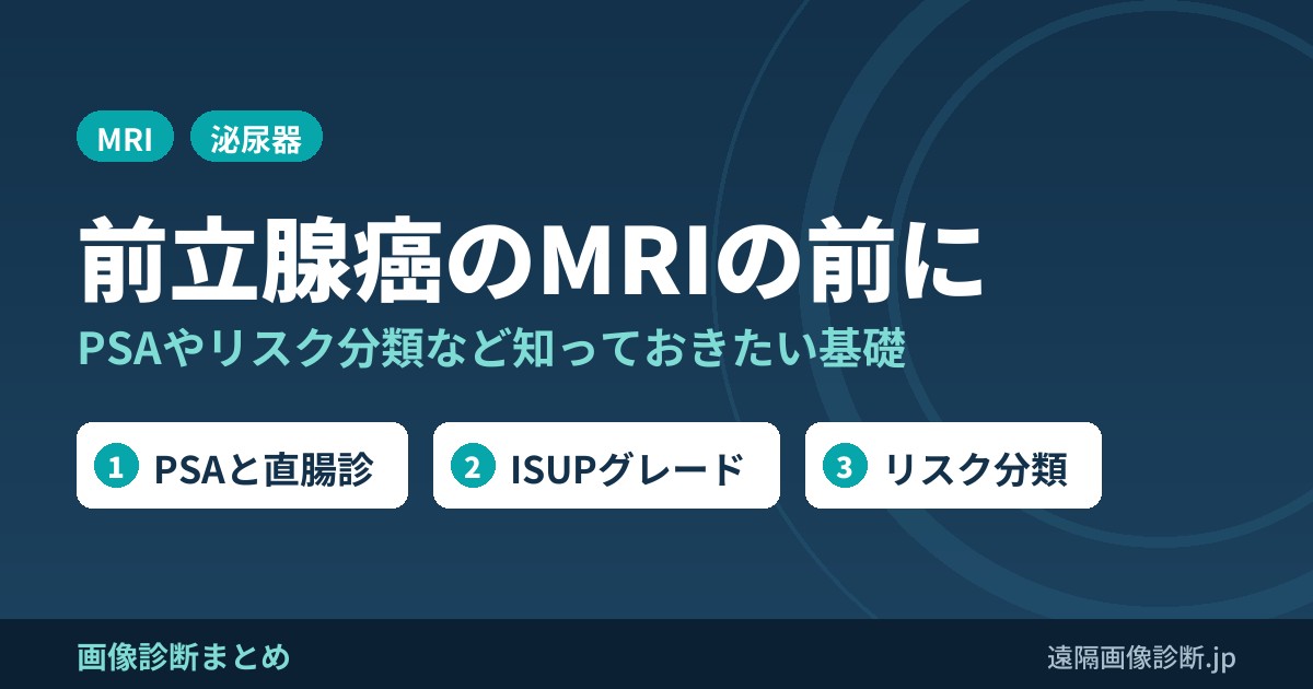 前立腺癌のMRI画像診断をする以前に知っておくべき事