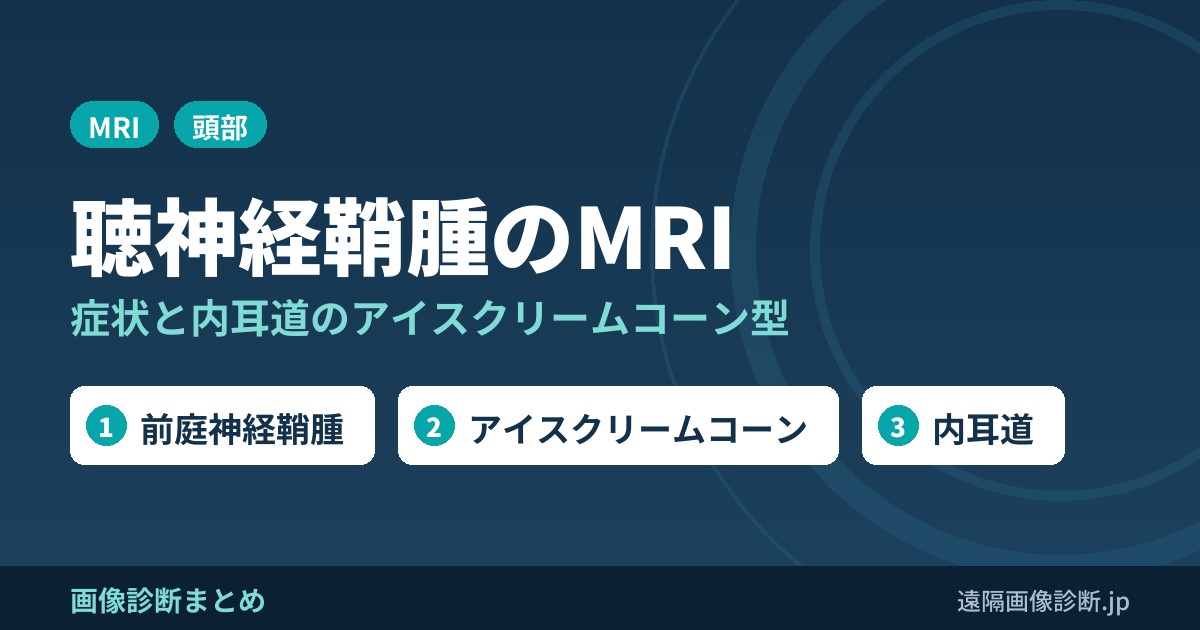 聴神経鞘腫(聴神経腫瘍)とは？読み方・英語・症状とMRI画像所見(内耳道のアイスクリームコーン型)