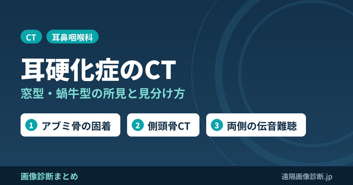 耳硬化症(otosclerosis)のCT画像診断｜窓型・蝸牛型とfissula ante fenestramの所見