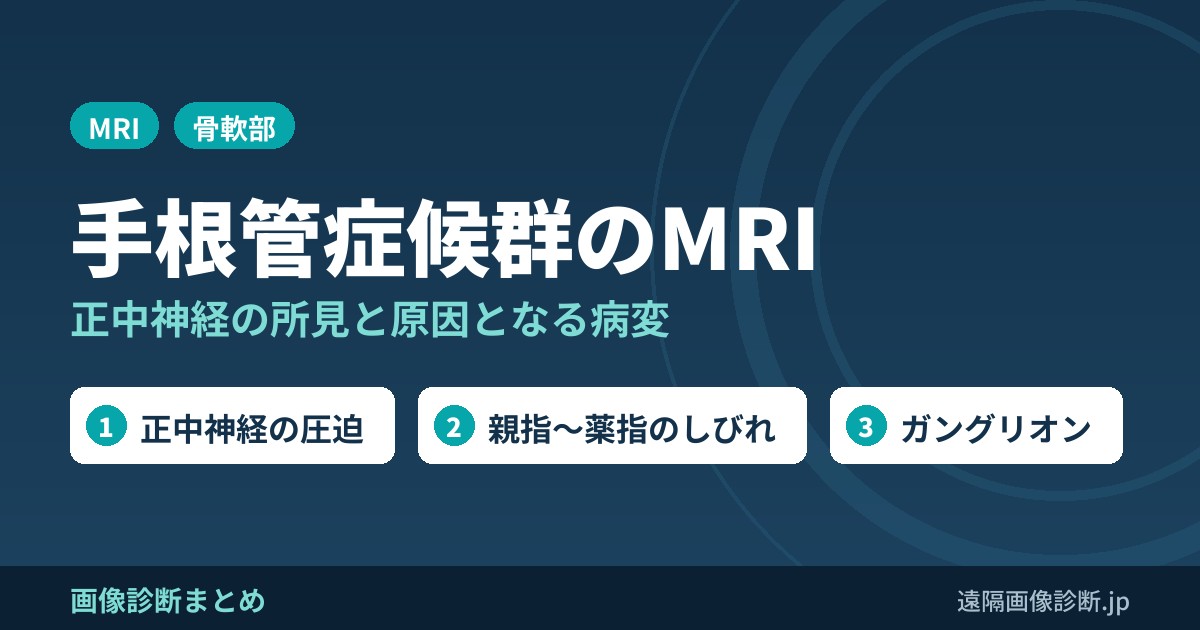 手根管症候群のMRI画像診断｜正中神経の所見と原因(腱鞘炎・ガングリオンなど)