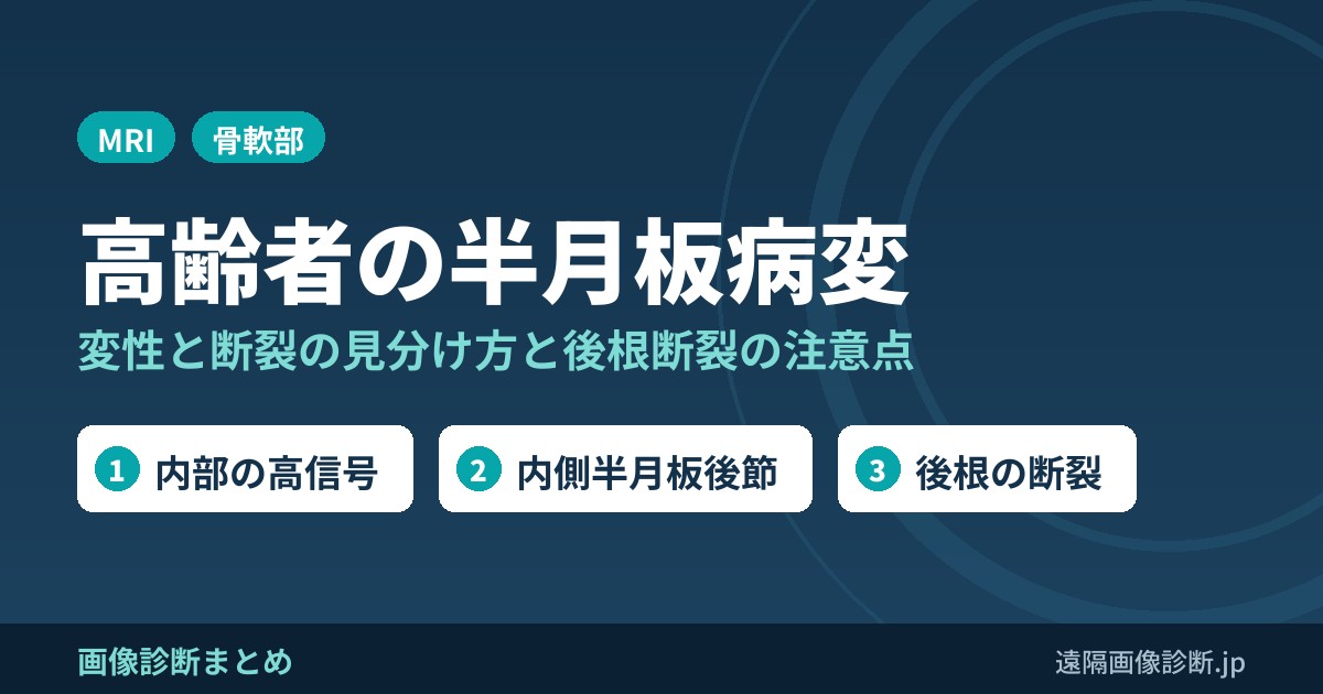 高齢者の半月板病変について