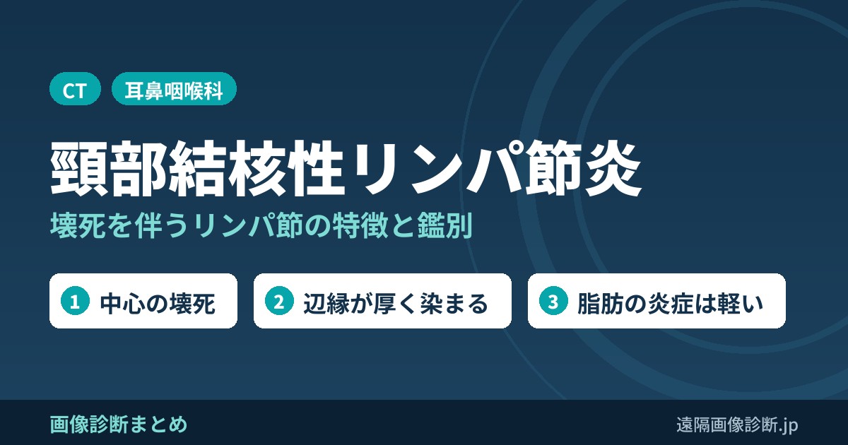 頸部結核性リンパ節炎の画像診断