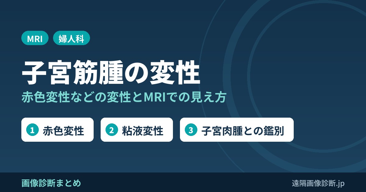 子宮筋腫の変性のMRI画像診断｜赤色変性・粘液変性・嚢胞変性と子宮肉腫との鑑別