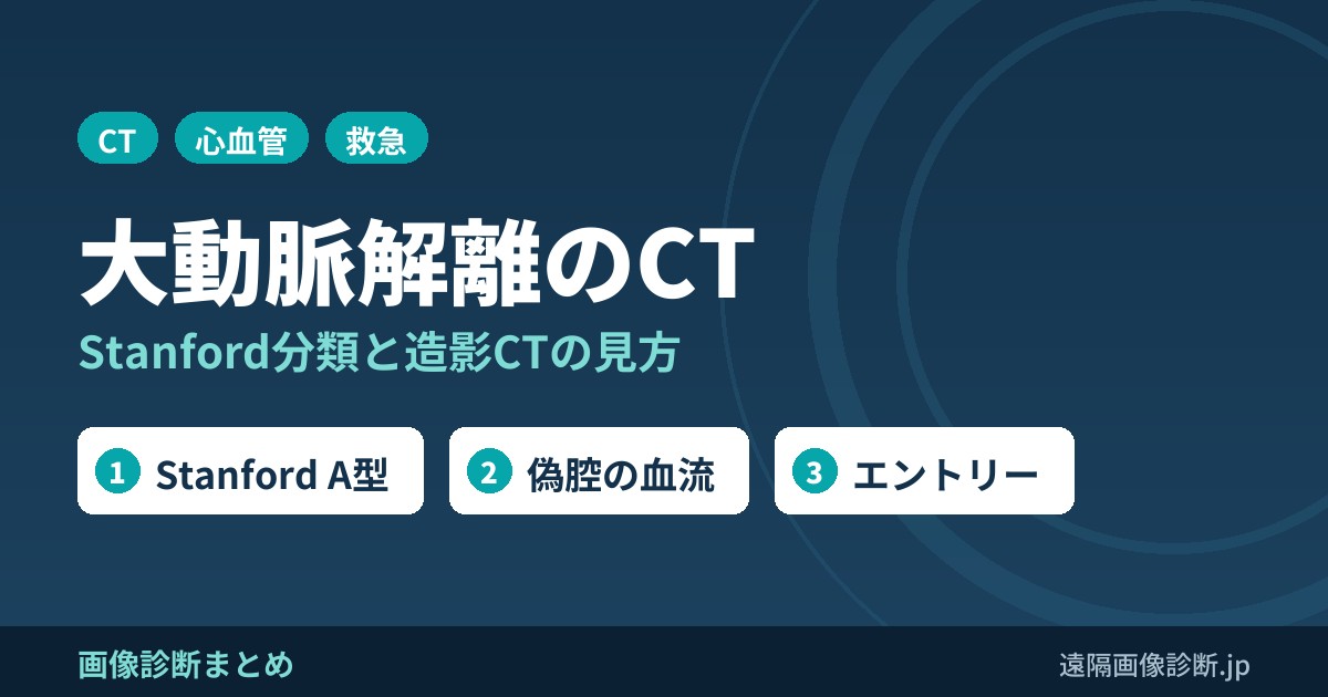 大動脈解離のCT画像診断のポイントは？分類は？