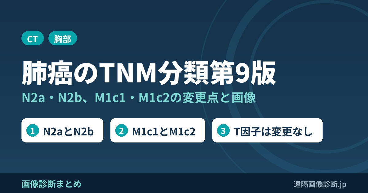 肺癌のTNM分類と病期分類(第9版)｜N2a・N2b、M1c1・M1c2の変更点と画像診断のポイント