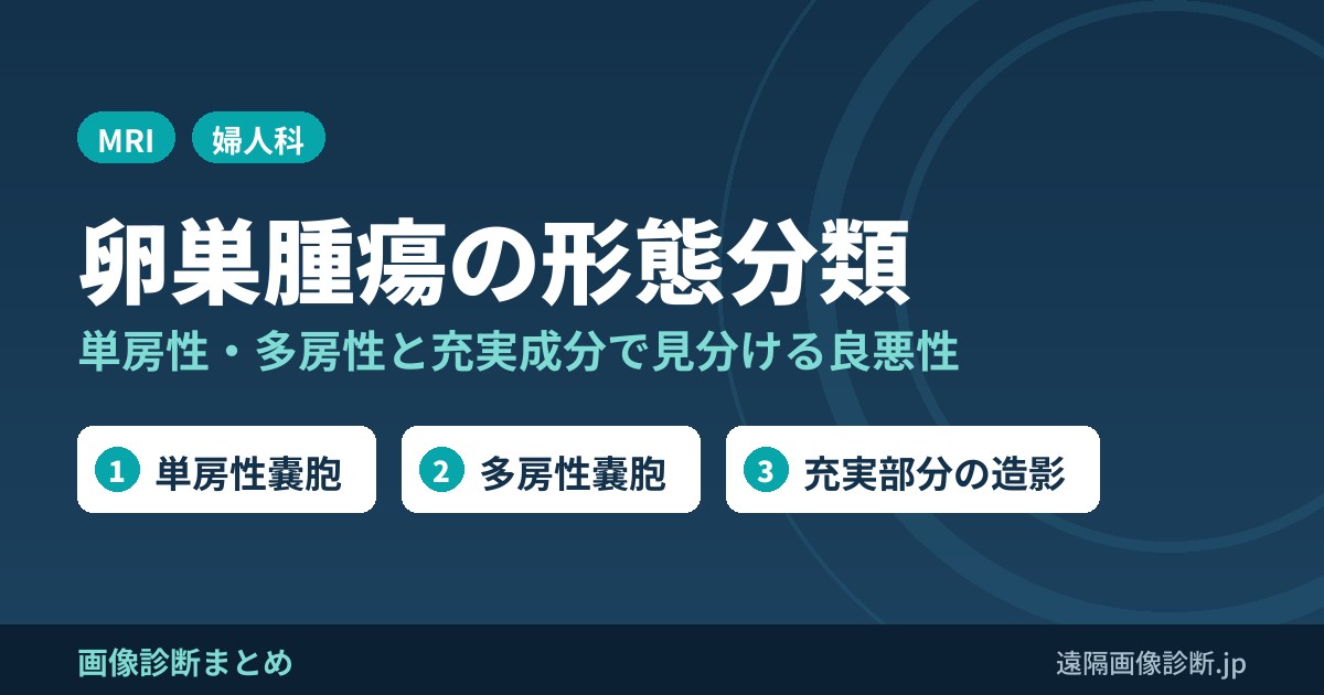 卵巣腫瘍の画像診断｜単房性・多房性嚢胞と充実成分で見分ける良性・悪性(MRI鑑別)
