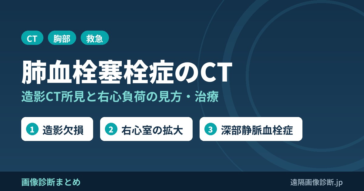 肺血栓塞栓症(肺塞栓症)のCT画像診断｜症状・原因と造影CT所見、右心負荷・治療