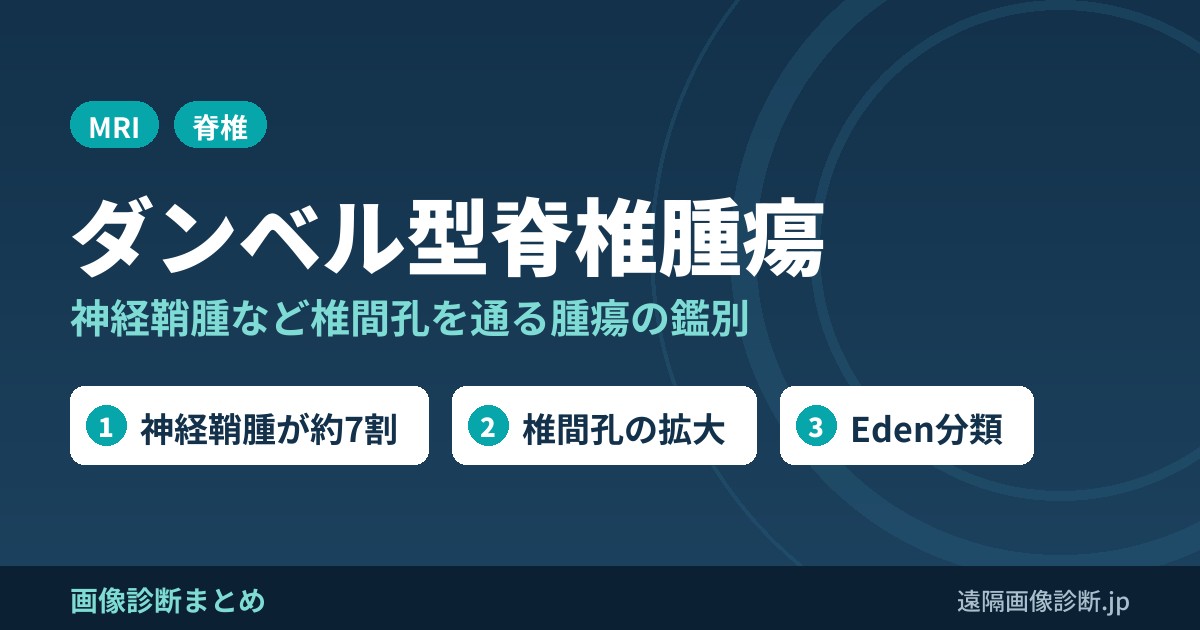 脊椎(椎体、脊髄)のダンベル型(鉄亜鈴型腫瘍)の鑑別診断は？