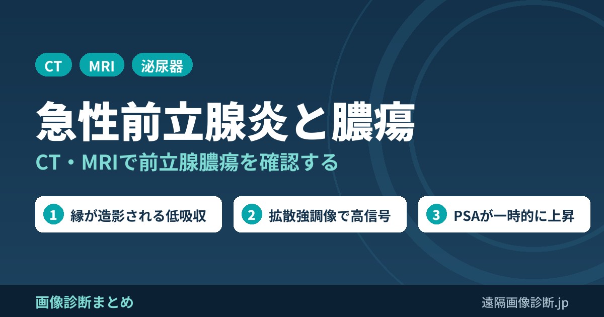 急性前立腺炎・前立腺膿瘍のCT・MRI画像診断