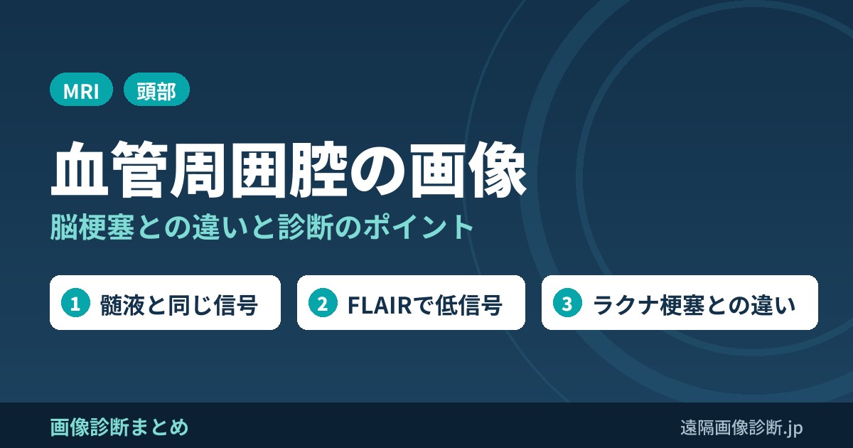 脳梗塞ではない！血管周囲腔とは？画像診断のポイントは？