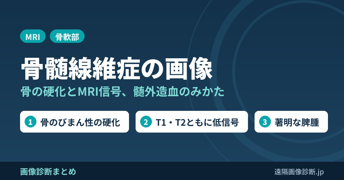 骨髄線維症(myelofibrosis)の画像診断