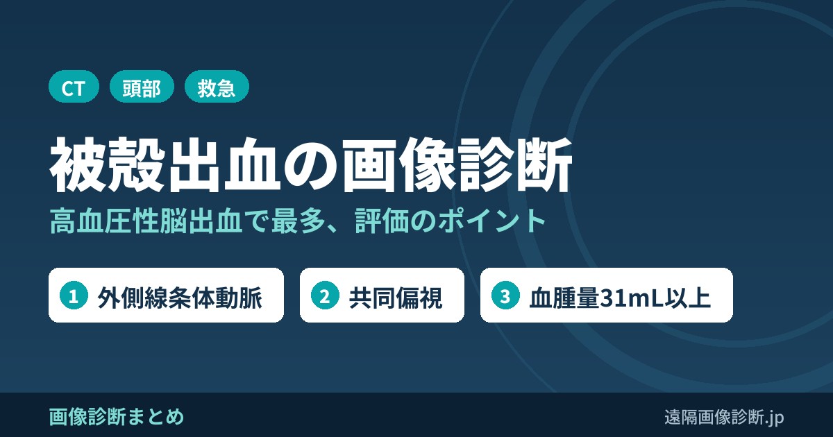 被殻出血の画像診断(高血圧性脳出血各論)