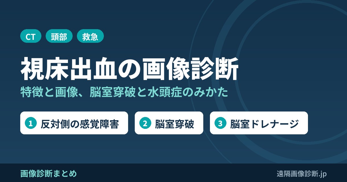 視床出血の特徴は？画像診断は？