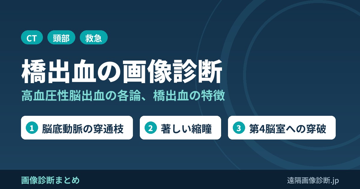 橋出血の画像診断(高血圧性脳出血各論)