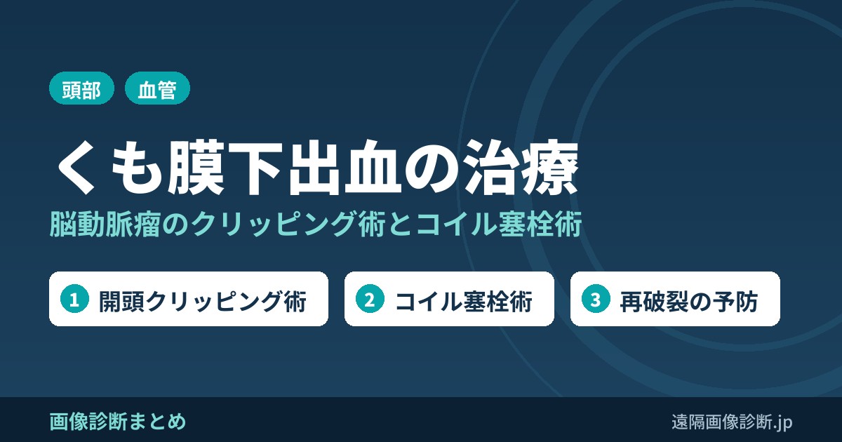 くも膜下出血・脳動脈瘤の治療(SAH、クリッピング術、コイル塞栓術)
