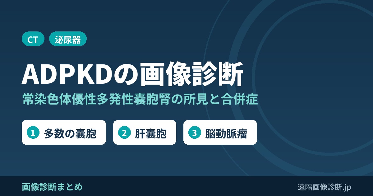 常染色体優性多発性嚢胞腎(ADPKD、成人型)の画像診断