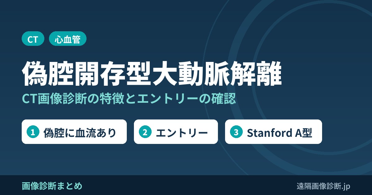 偽腔開存型大動脈解離とは？CT画像診断の特徴は？