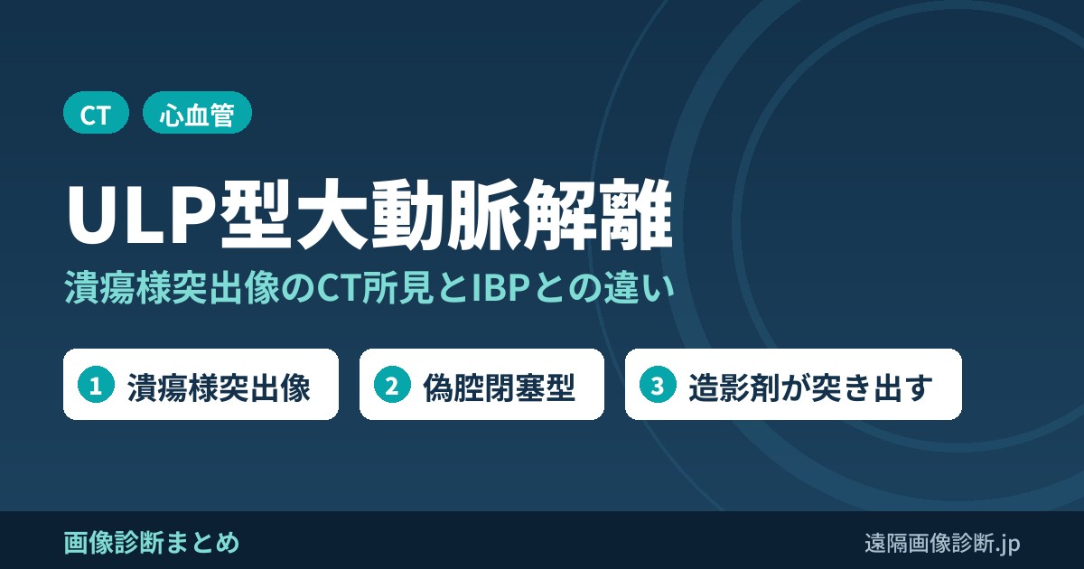 ULPとは？ULP型大動脈解離(ulcer-like projection)のCT画像所見とIBP・PAUとの違い