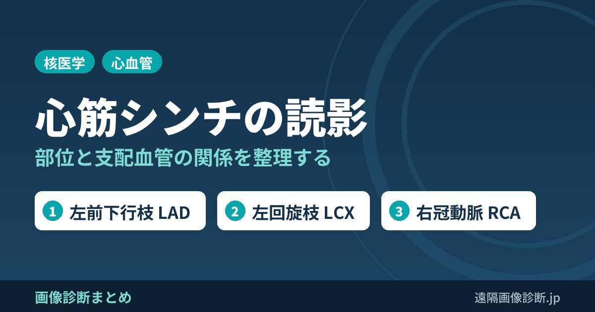 心筋シンチグラフィの読影の仕方(支配血管と部位の関係)