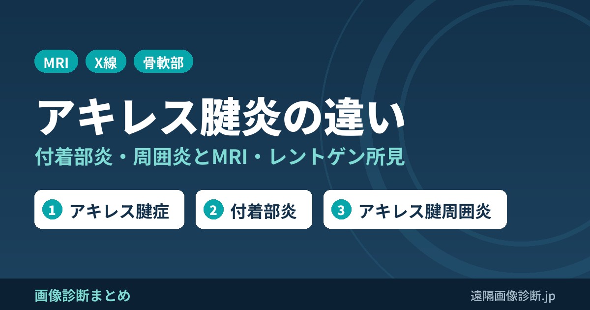 アキレス腱炎・付着部炎・周囲炎の違いとMRI・レントゲン画像所見
