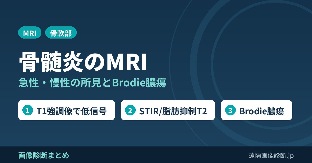 骨髄炎のMRI画像診断｜急性・慢性骨髄炎の所見とBrodie膿瘍(penumbra sign)