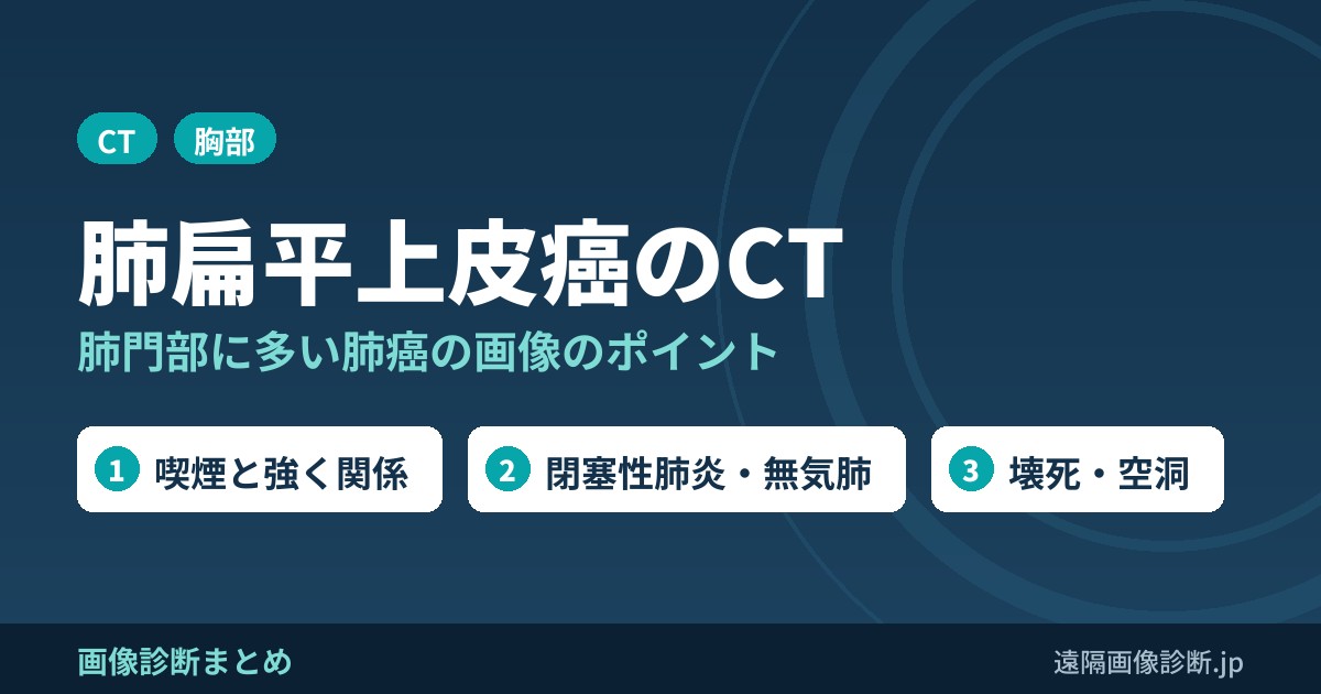 肺扁平上皮癌のCT画像診断のポイントは？