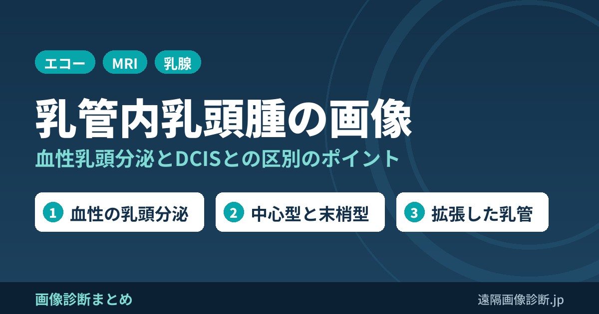 乳管内乳頭腫の画像診断(intraductal papilloma:IDP)