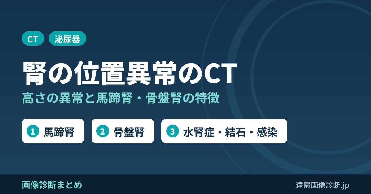 腎の高さの異常の種類は？CT画像の特徴は？