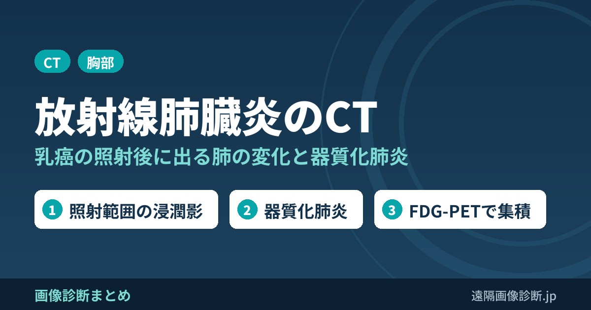 乳癌放射線療法の合併症である放射線肺臓炎・器質化肺炎のCT画像診断