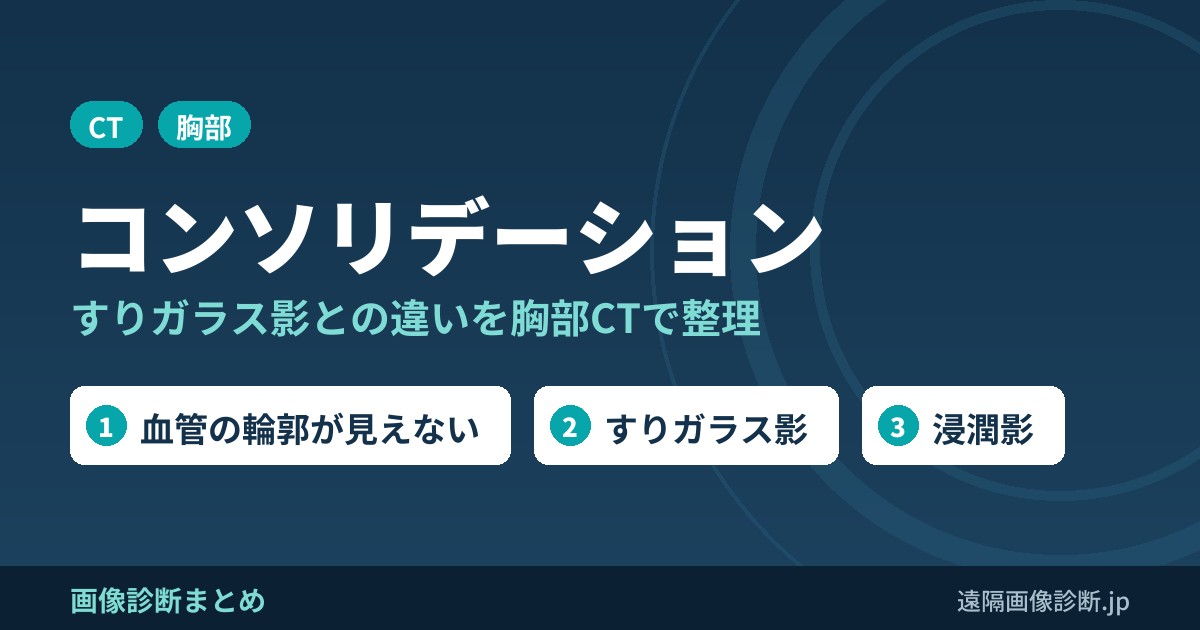 コンソリデーション（consolidation）とすりガラス影とは？