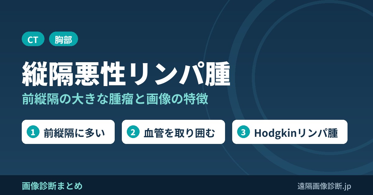 縦隔悪性リンパ腫の画像診断