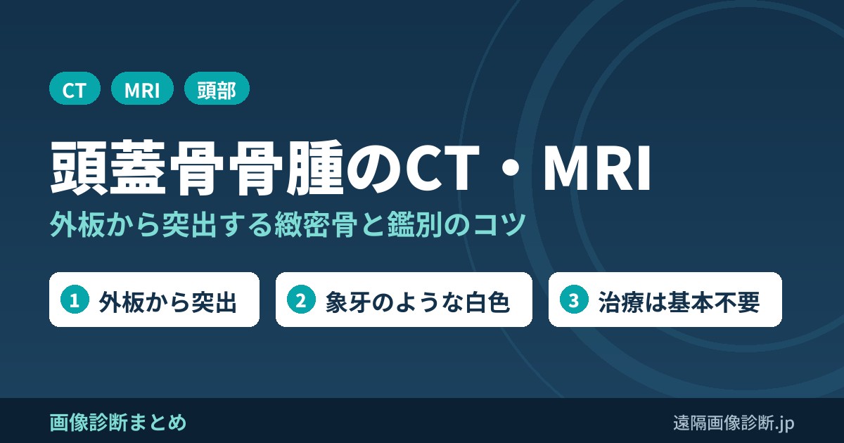 頭蓋骨骨腫(skull osteoma)のCT・MRI画像所見｜外板から突出する緻密骨と鑑別