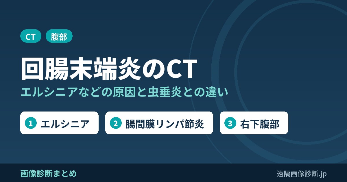 回腸末端炎(回盲部炎)とは？原因(エルシニアなど)・症状とCT画像所見、虫垂炎との違い