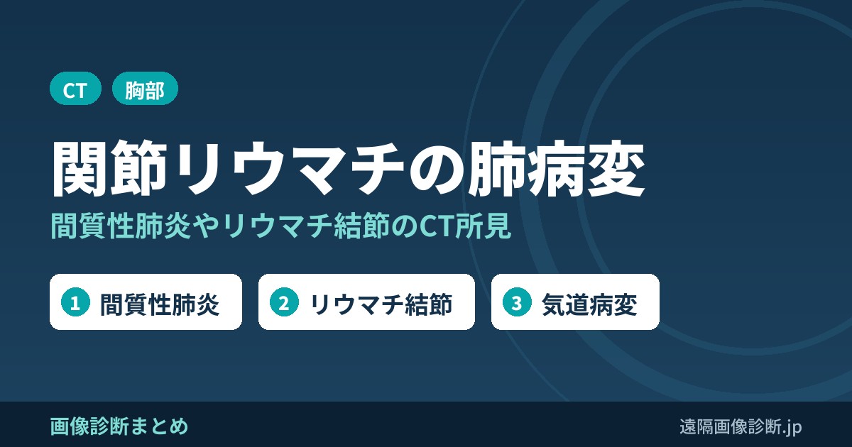 関節リウマチの肺病変のCT所見｜リウマチ結節(肺)・間質性肺炎・気道病変・MTX肺炎