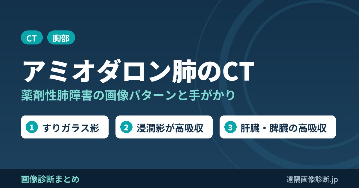 アミオダロン肺のCT画像診断