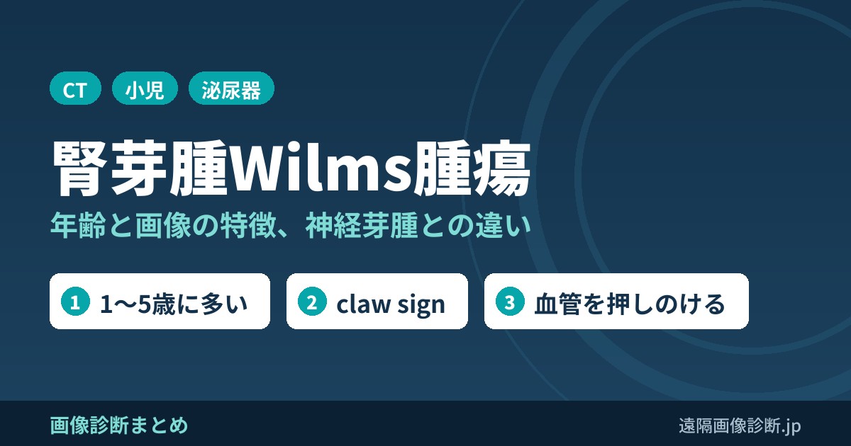 腎芽腫(Wilms腫瘍)の症状、年齢、画像診断、治療