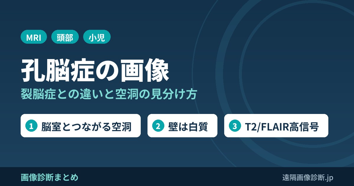 孔脳症の画像診断